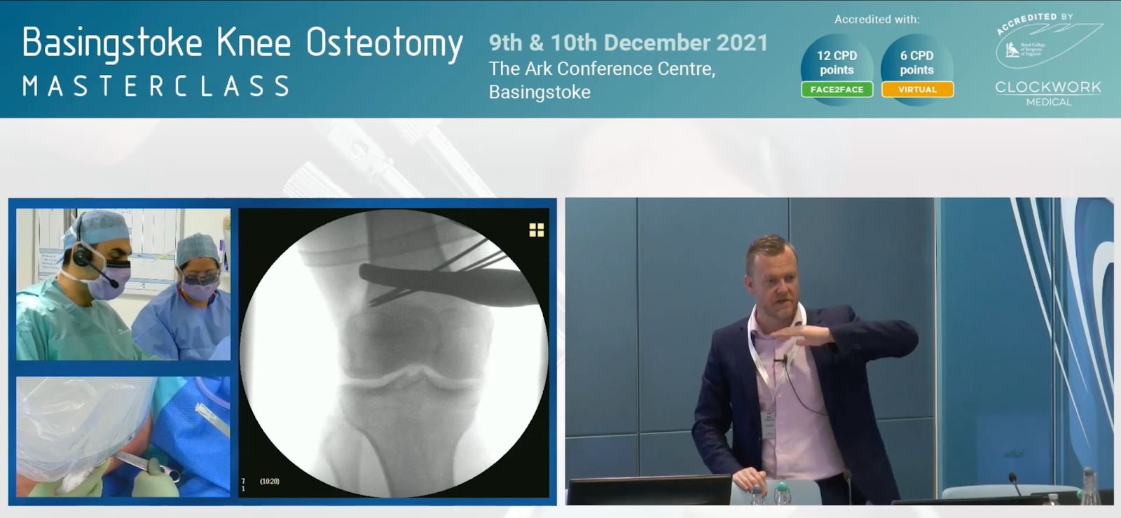 Basingstoke Knee Osteotomy<br>Masterclass